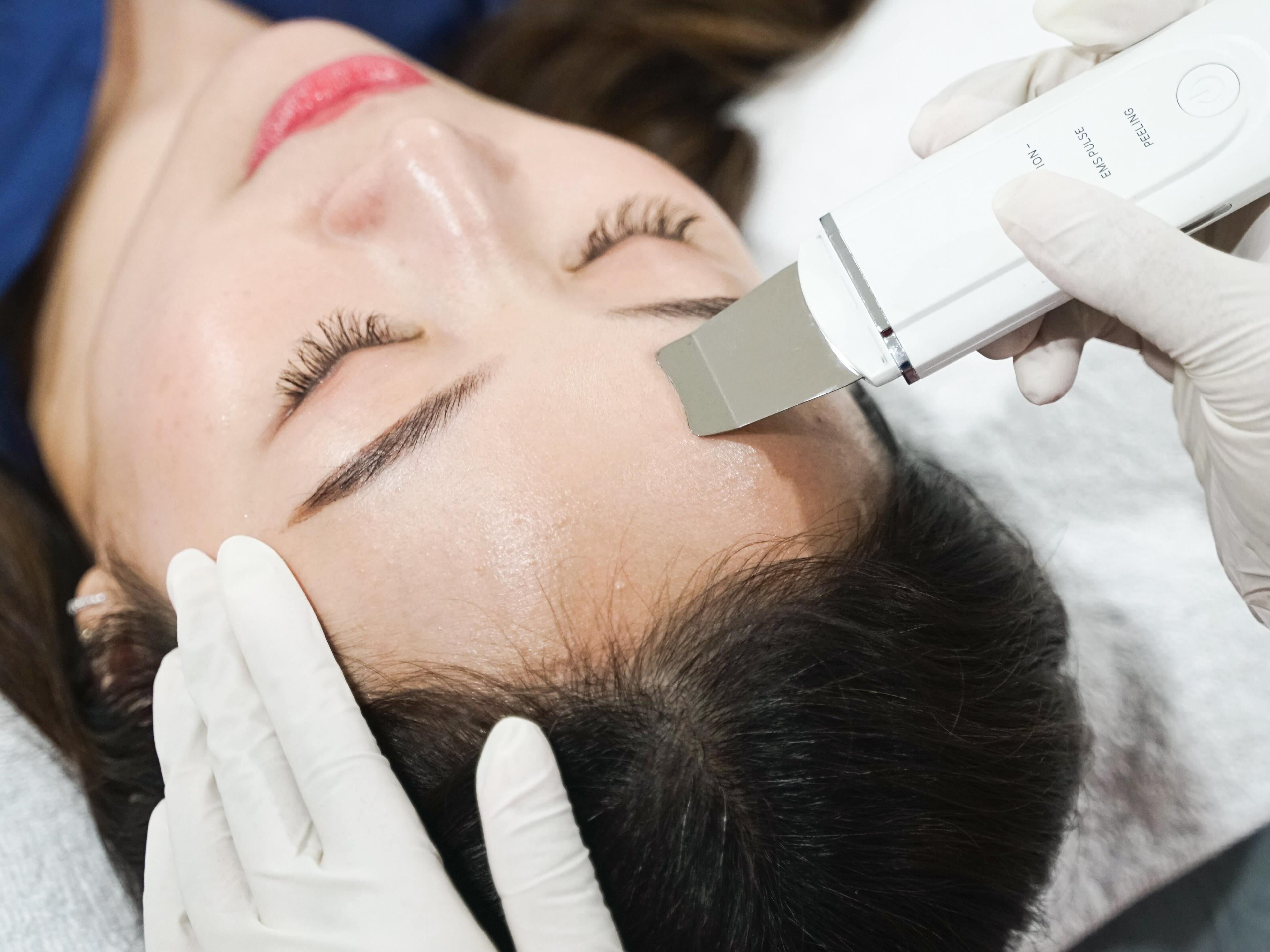 Pasien Somer Clinic dengan kulit glowing