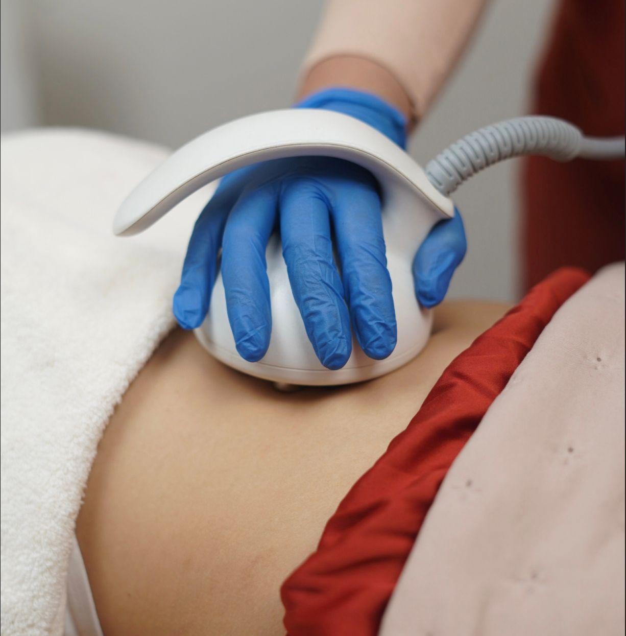 RF Body by Venus Freeze